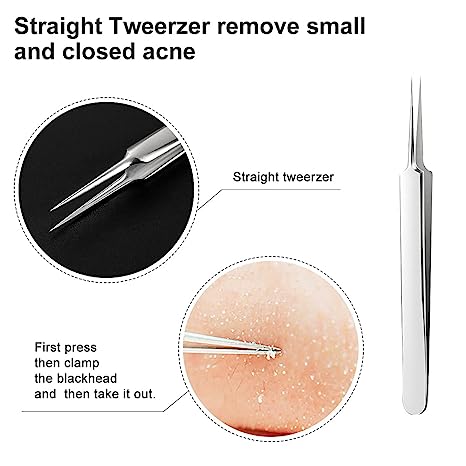 Professional Ultra-fine No.5 Acne Blackhead Removal Tweezers (Pcs 3)