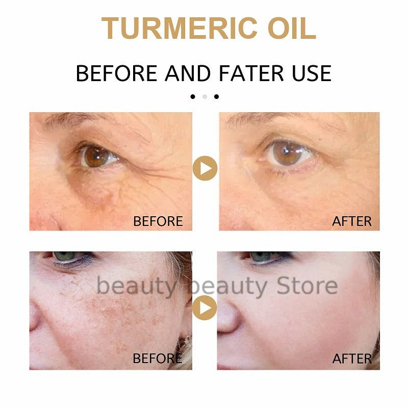 Organic Turmeric Dark Spot Corrector Serum - Skin Brightening and Nourishing