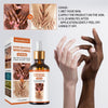 Load image into Gallery viewer, Revolutionary Acanthosis Nigricans Therapy Oil: Transform Your Skin and Boost Confidence