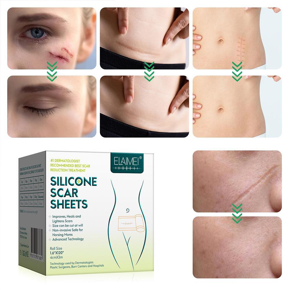 Silicone Scar Patch Removal
